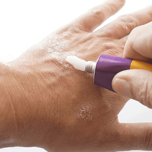 Topical steroids (part 2 of 2)